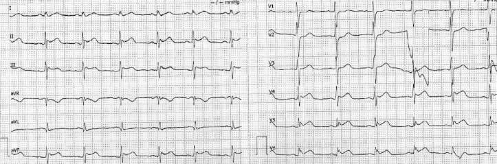 Captura de pantalla 2017-09-05 a la(s) 23.22.23.png