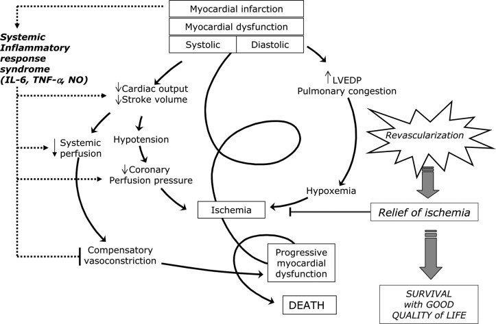 Cardiogenic-Shock