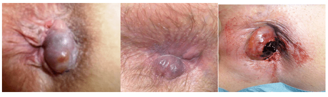 Captura de pantalla 2017-10-04 a la(s) 16.15.32.png