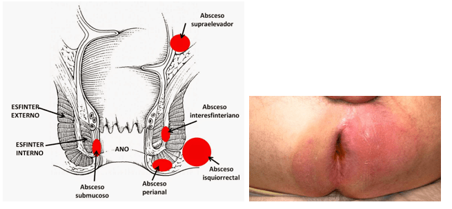 Captura de pantalla 2017-10-04 a la(s) 16.18.36.png