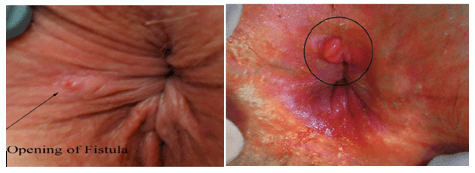 Captura de pantalla 2017-10-04 a la(s) 16.22.48.png